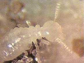 Traitement Termites - Nymphe